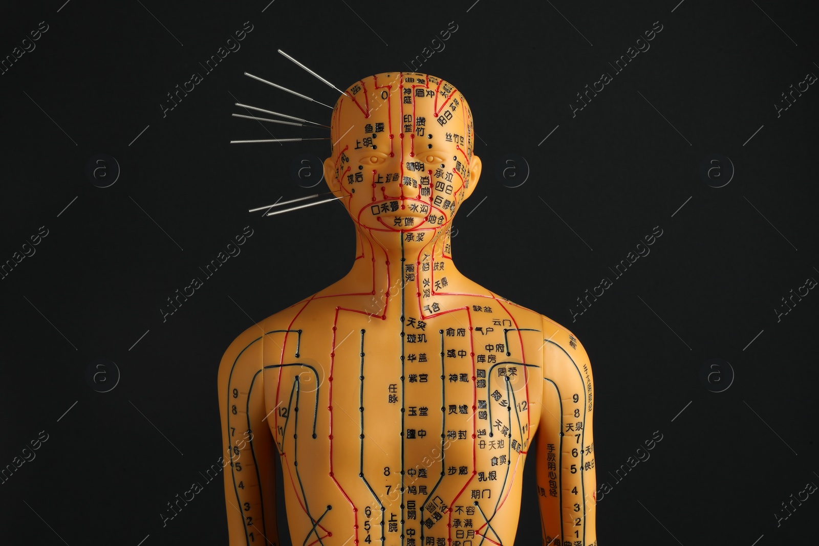 Photo of Acupuncture - alternative medicine. Human model with needles in head on black background