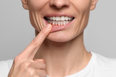 Image of Woman showing inflamed gum on grey background, closeup