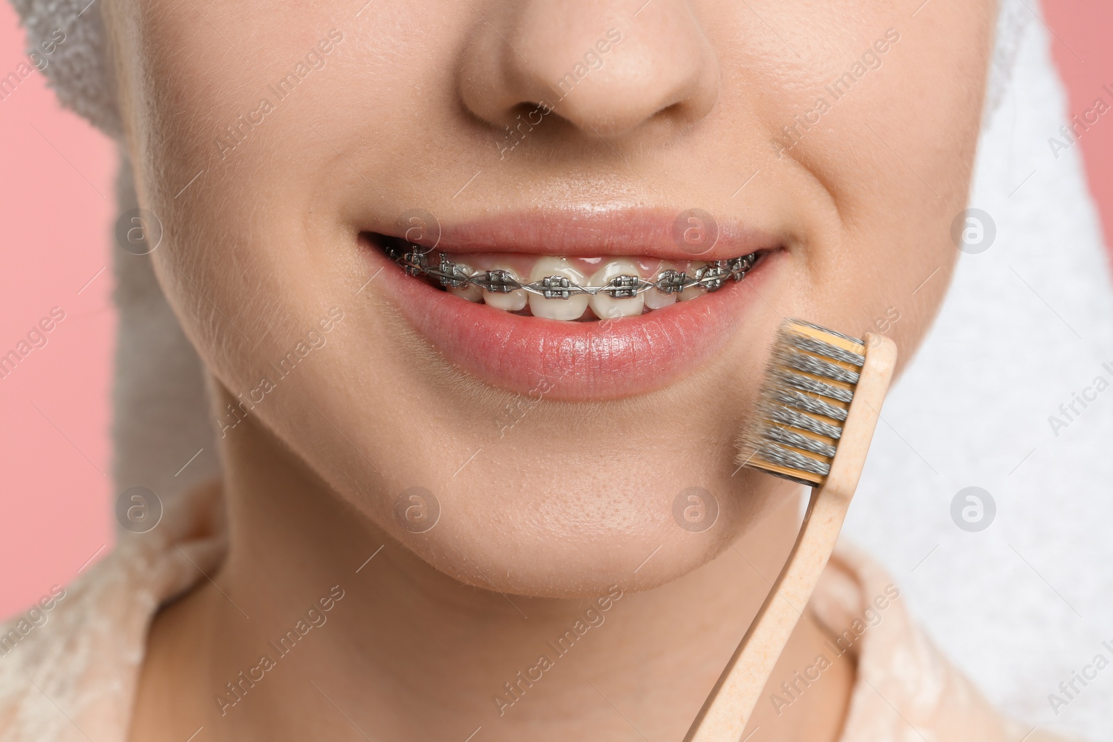 Photo of Smiling woman with dental braces and toothbrush, closeup