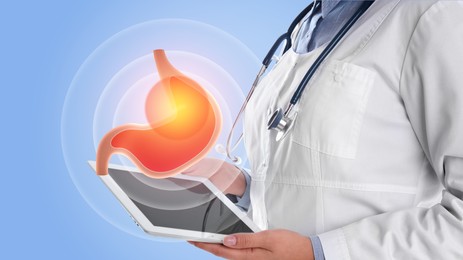 Treatment of heartburn and other gastrointestinal diseases. Doctor using tablet on light blue background, closeup. Stomach illustration over device