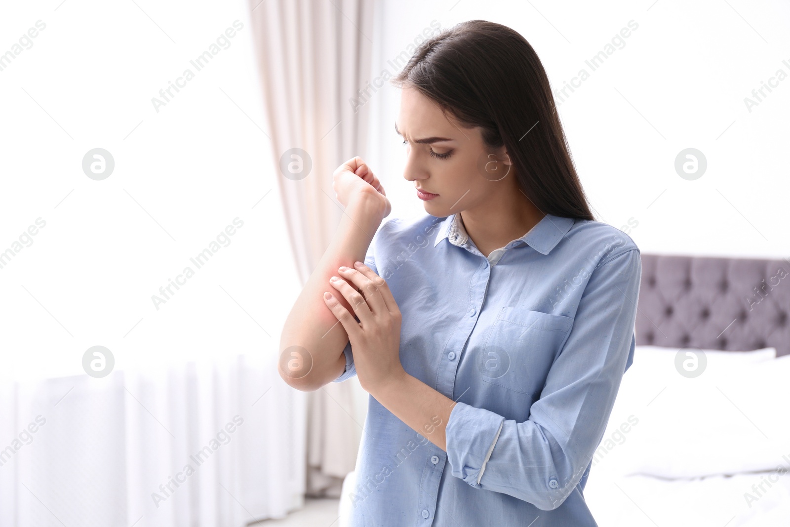 Photo of Young woman scratching hand indoors, space for text. Allergies symptoms