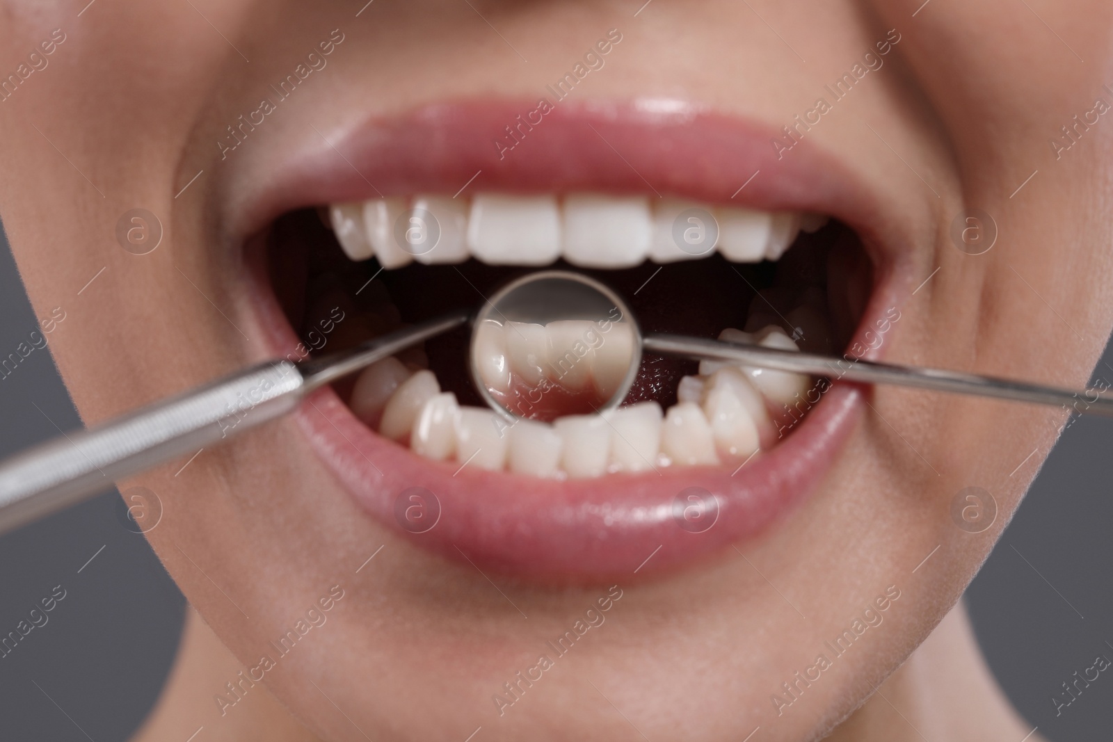 Photo of Examining woman's teeth with dentist's mirror on grey background, closeup