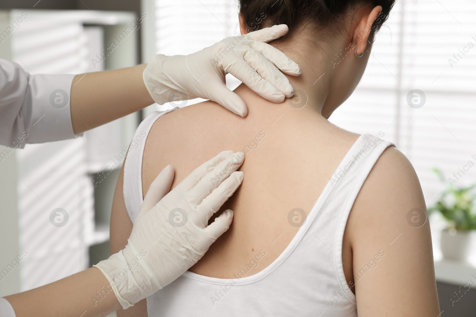 Photo of Dermatologist examining patient's birthmark in clinic, closeup view