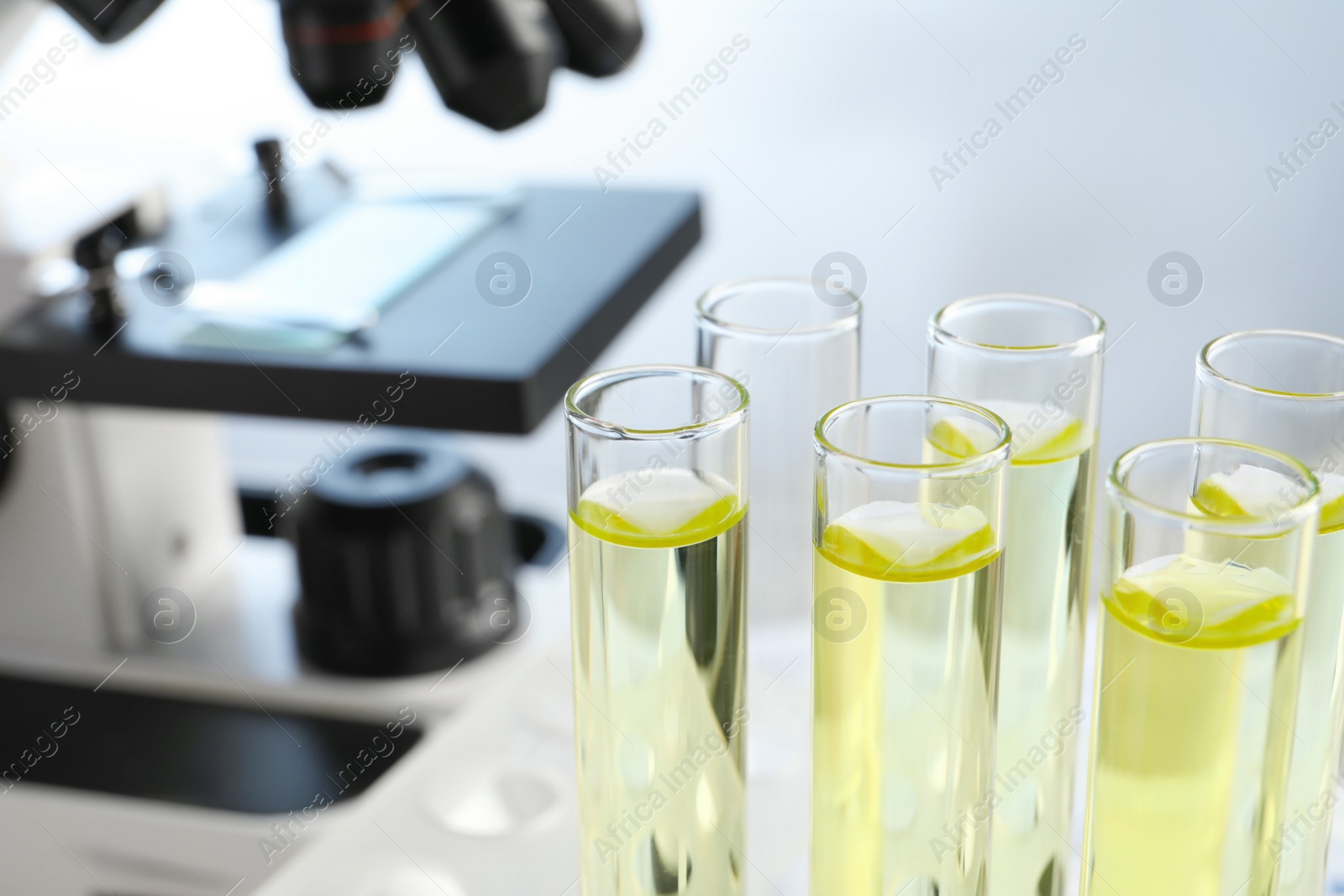 Photo of Test tubes with urine samples for analysis in laboratory, closeup