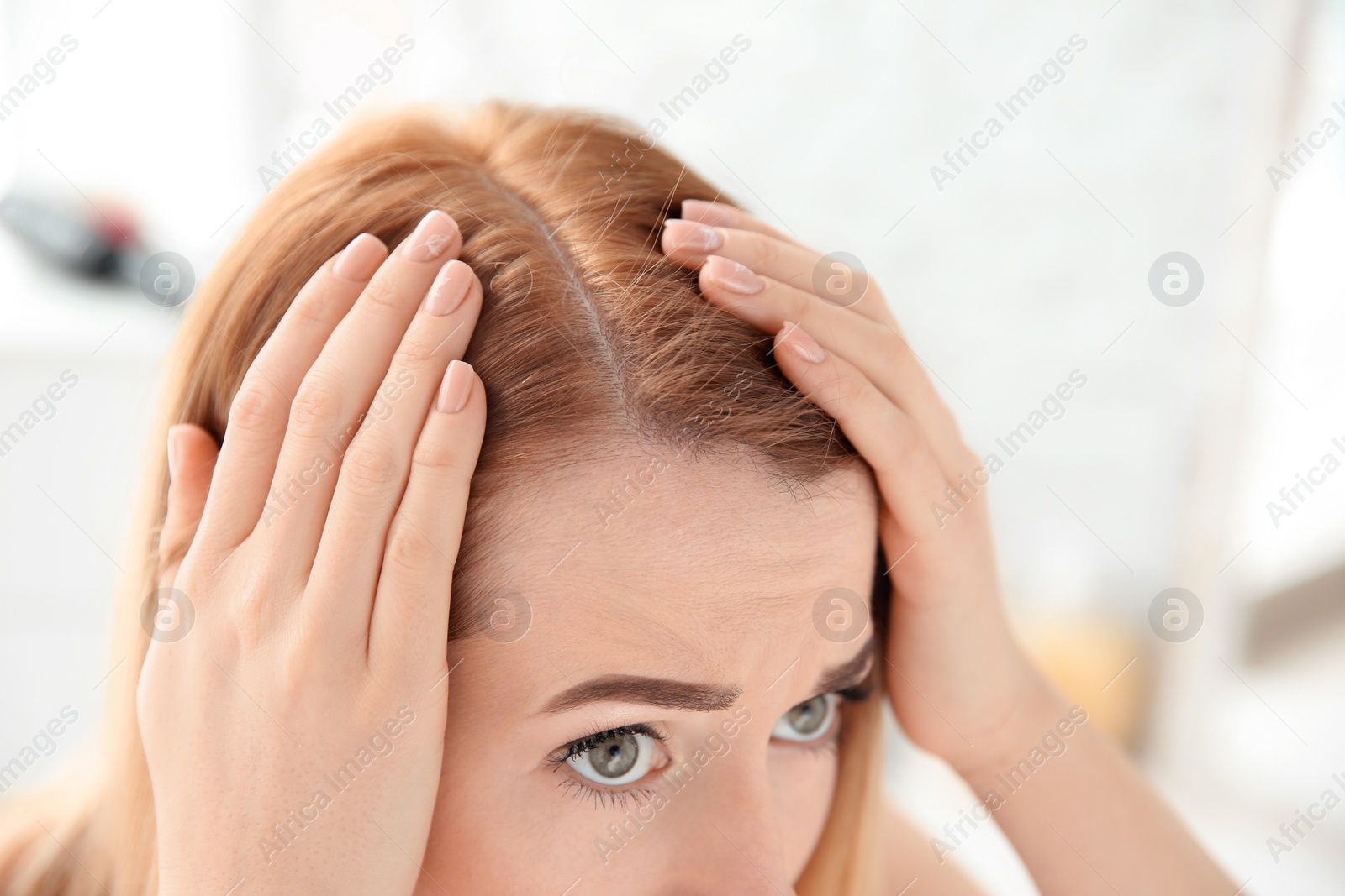 Photo of Young woman with hair loss problem at home, closeup