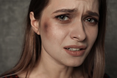 Photo of Abused young woman on grey background. Stop violence
