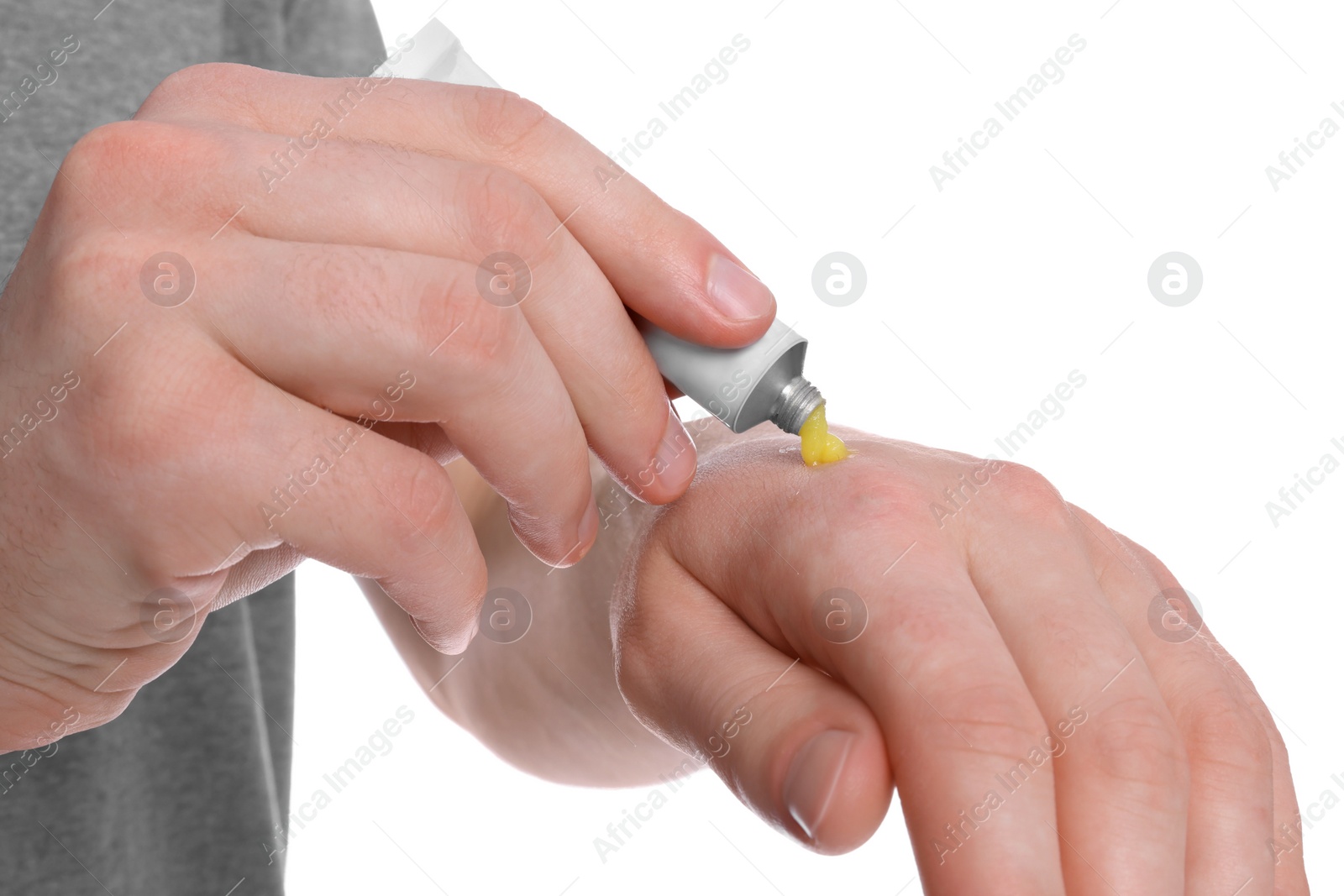 Photo of Man applying yellow ointment from tube onto his hand on white background, closeup