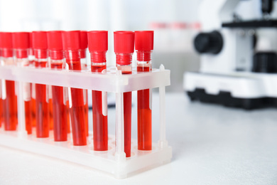 Photo of Test tubes with blood samples on table in laboratory, closeup. Virus research