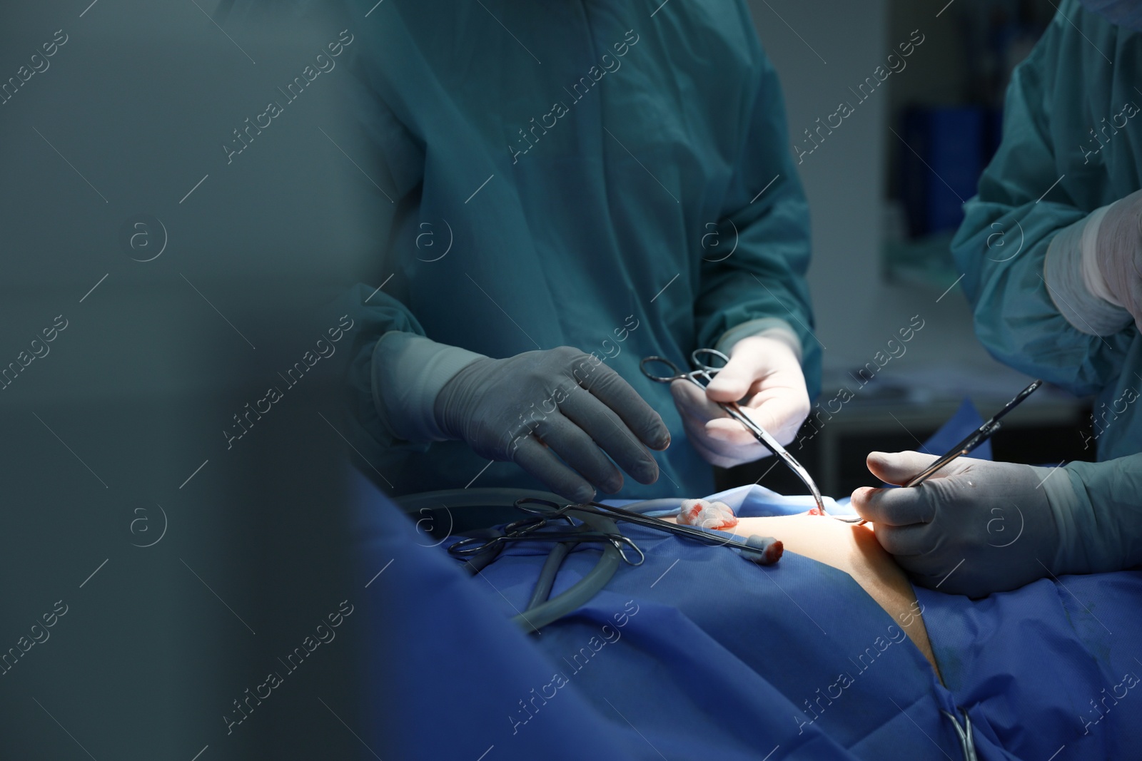 Photo of Medical team performing surgery in operating room, closeup