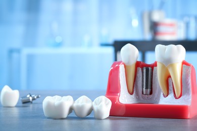 Educational model with post of dental implant between teeth and crowns on table indoors