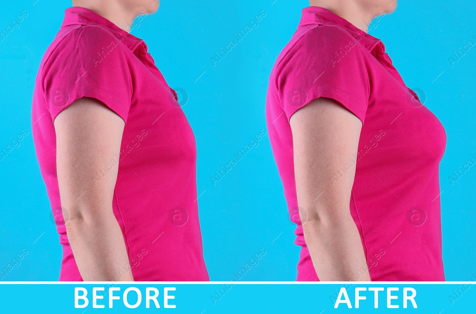 Image of Woman before and after breast augmentation on light blue background, closeup