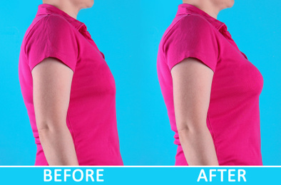 Image of Woman before and after breast augmentation on light blue background, closeup