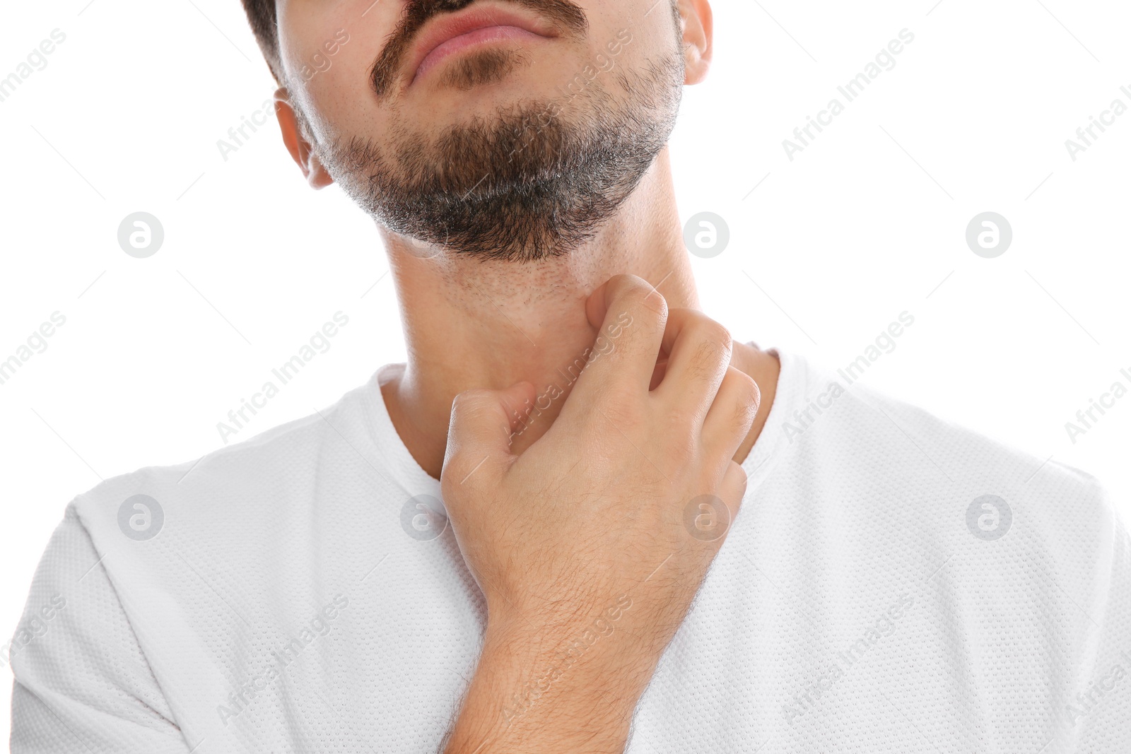 Photo of Young man scratching neck on white background, closeup. Annoying itch