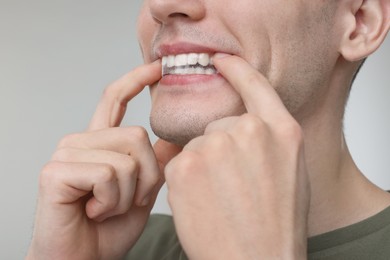 Young man applying whitening strip on his teeth against light grey background, closeup