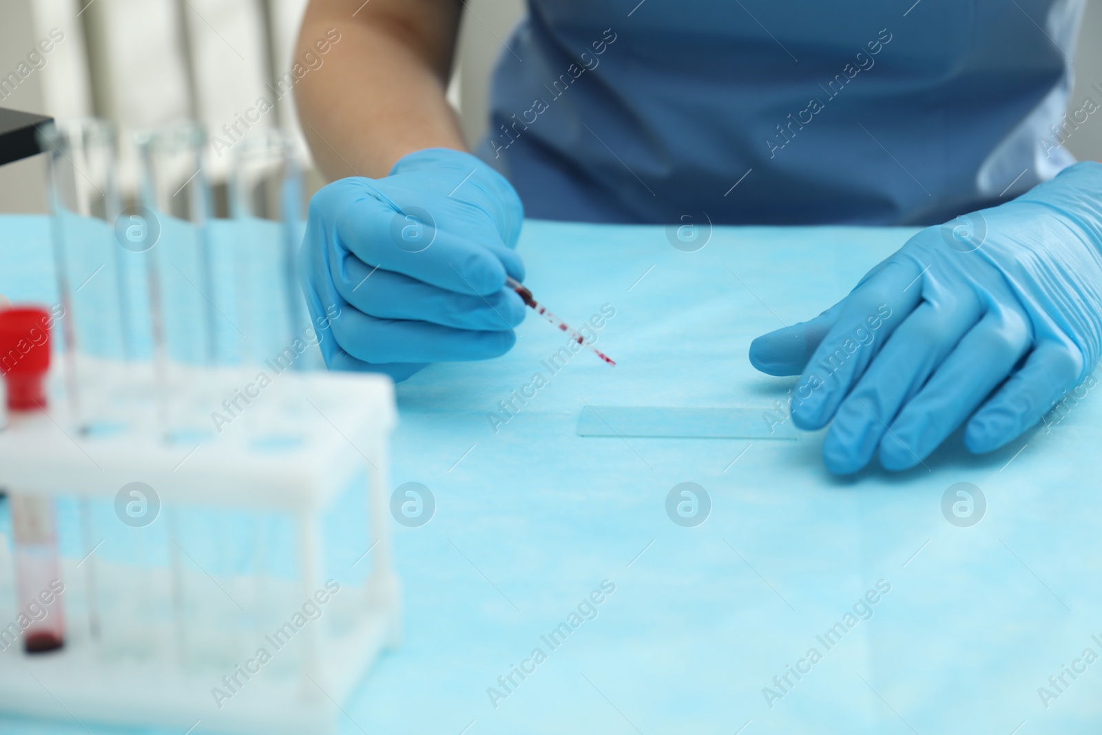 Photo of Doctor with blood sample from finger at table in laboratory, closeup