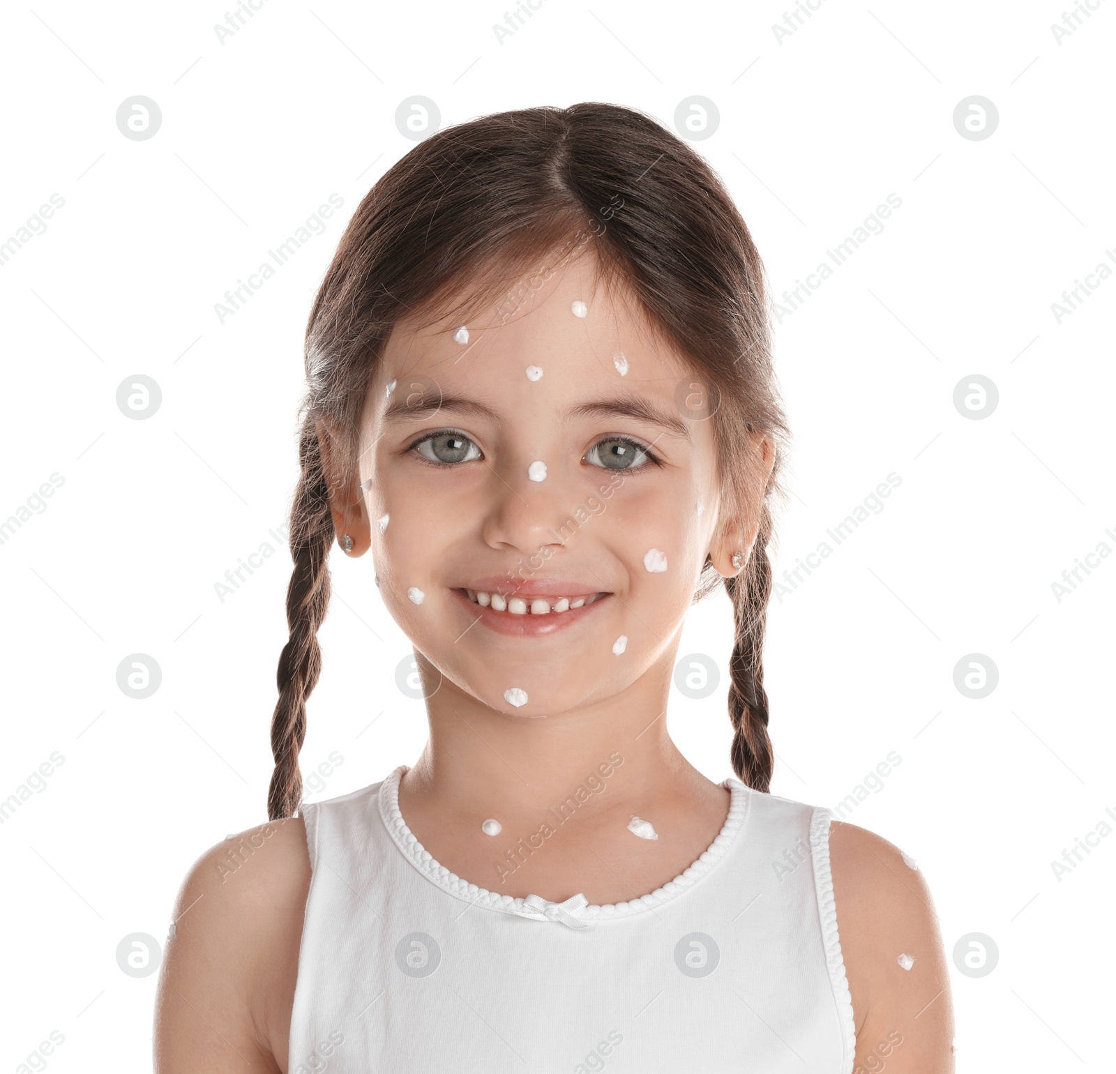 Photo of Little girl with chickenpox on white background