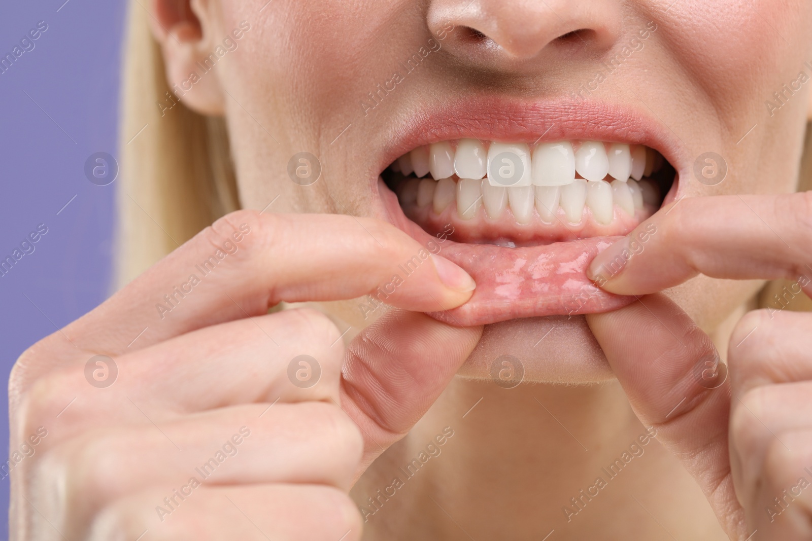 Photo of Woman showing her clean teeth on violet background, closeup view