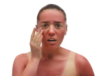 Woman with sunburned skin on white background