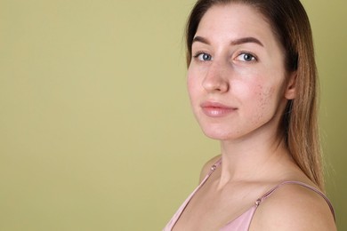 Photo of Young woman with acne problem on olive background. Space for text