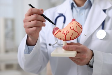 Photo of Gastroenterologist showing human stomach model in clinic, closeup