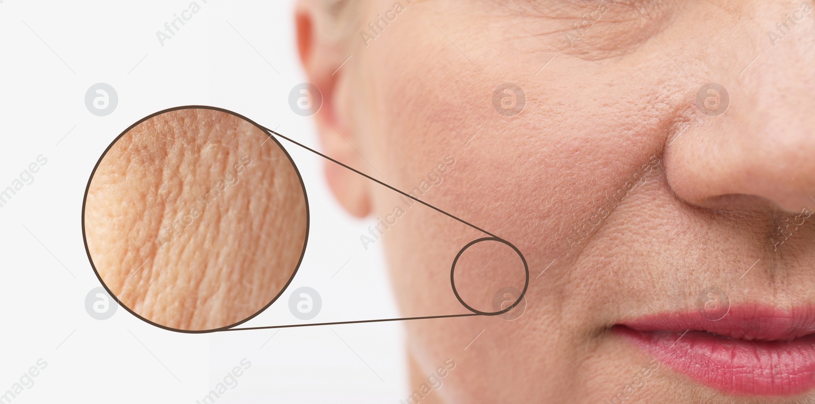 Image of Closeup view of mature woman with skin problem on white background. Banner design