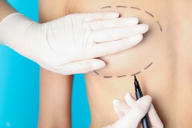 Photo of Doctor drawing marks on patient's breast for cosmetic surgery operation against color background, closeup