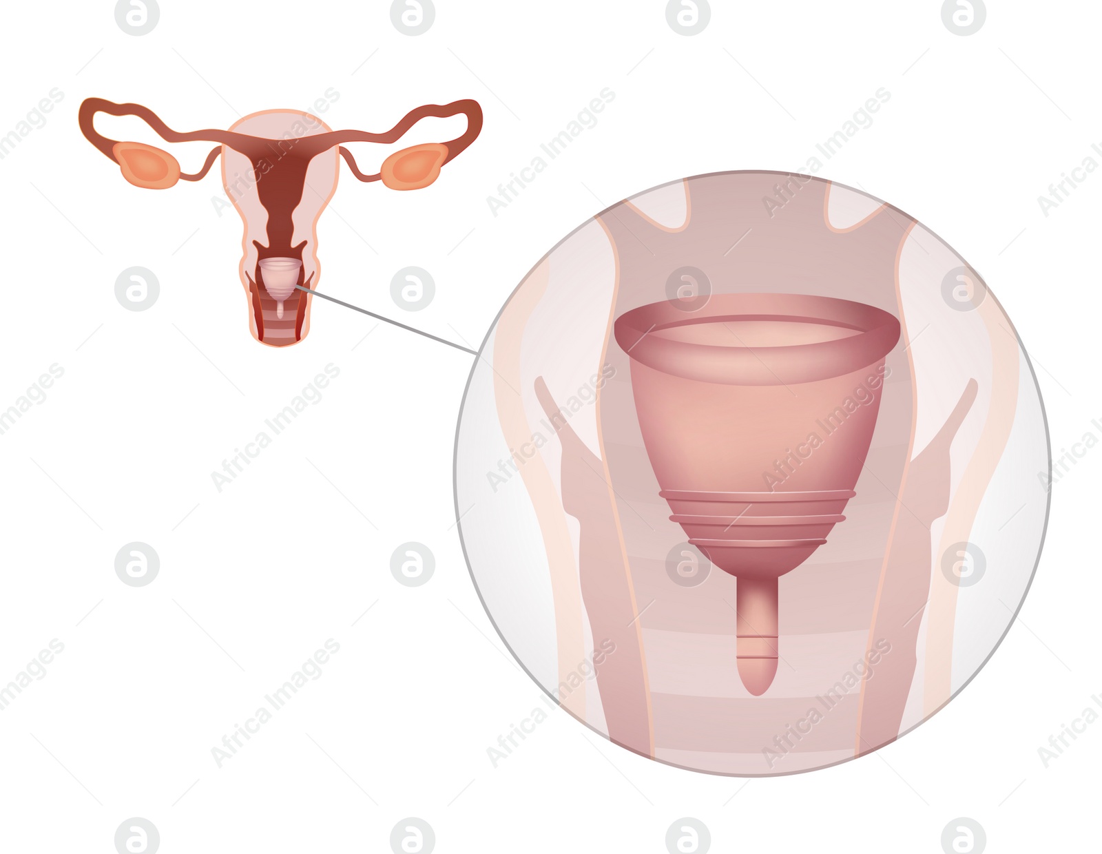 Illustration of Instruction how to use menstrual cup during period. Female reproductive system on white background, illustration