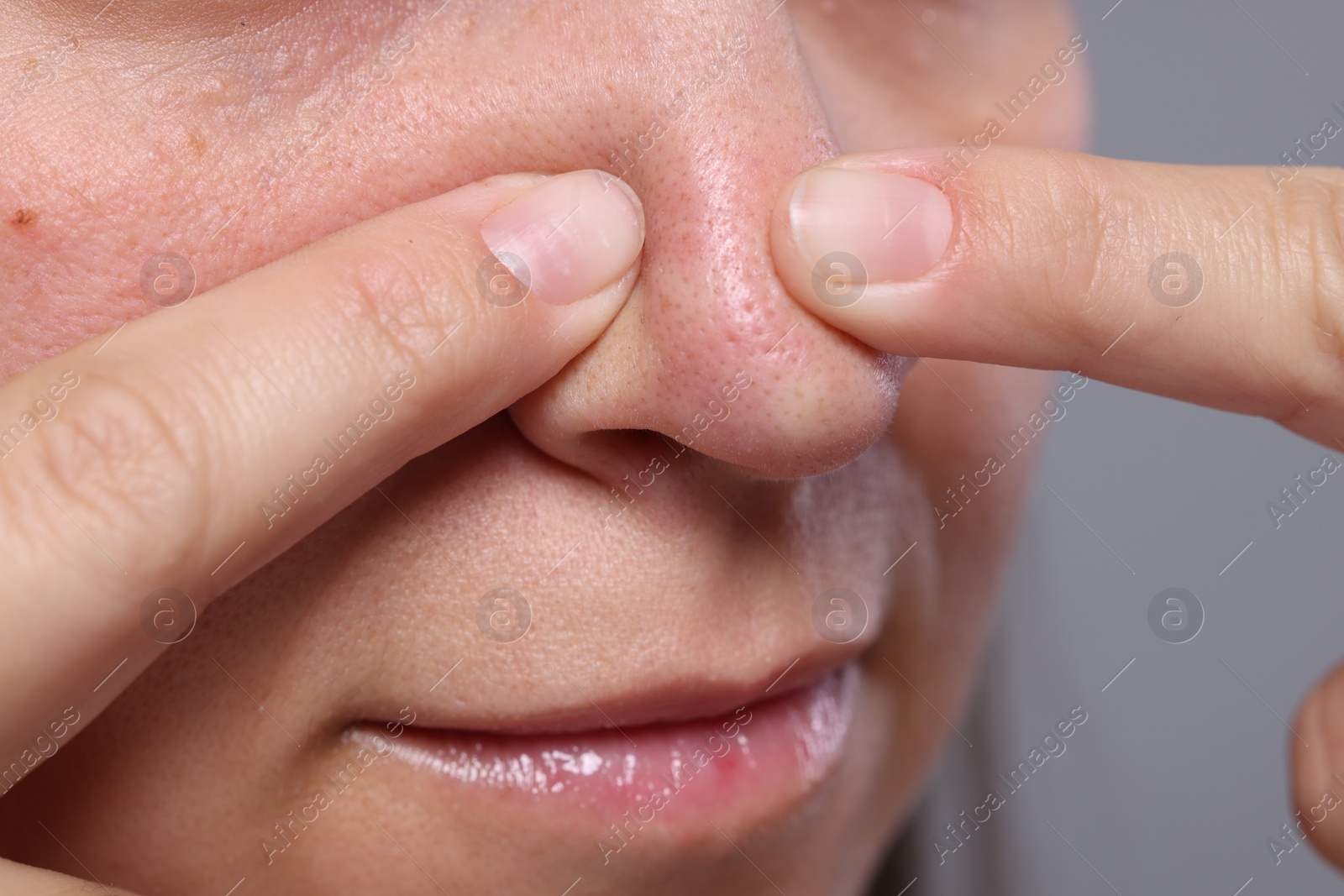 Photo of Woman popping pimple on her nose against grey background, closeup