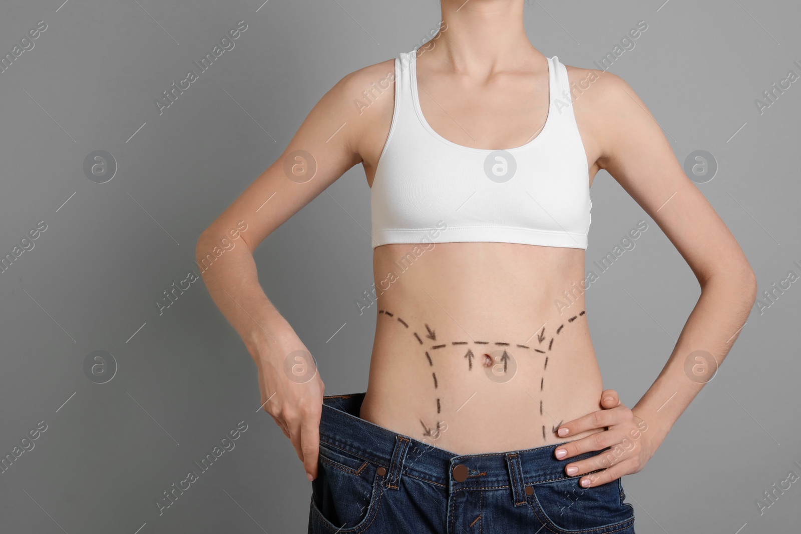 Photo of Young woman with marks on belly in big jeans after cosmetic surgery operation against color background