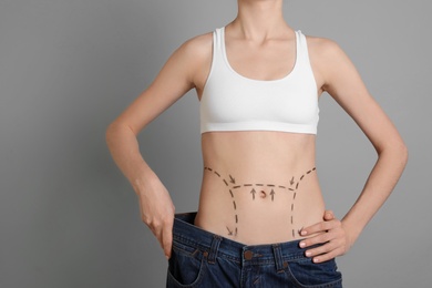 Photo of Young woman with marks on belly in big jeans after cosmetic surgery operation against color background