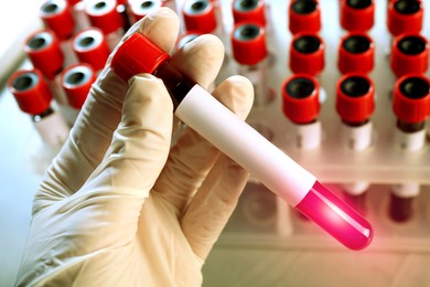 Image of Laboratory worker holding test tube with blood sample over table, closeup