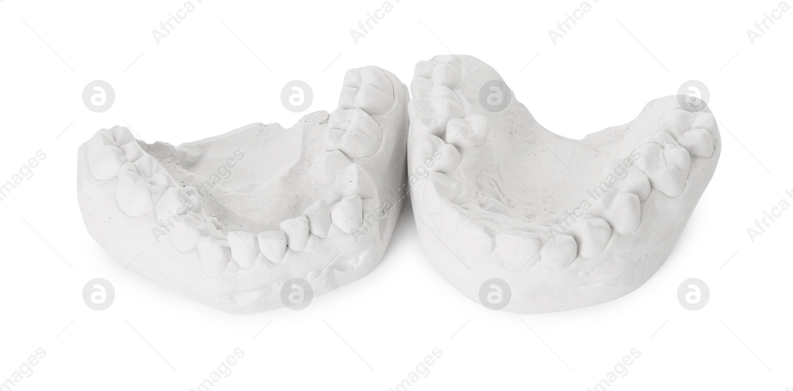 Photo of Dental model with gums isolated on white. Cast of teeth