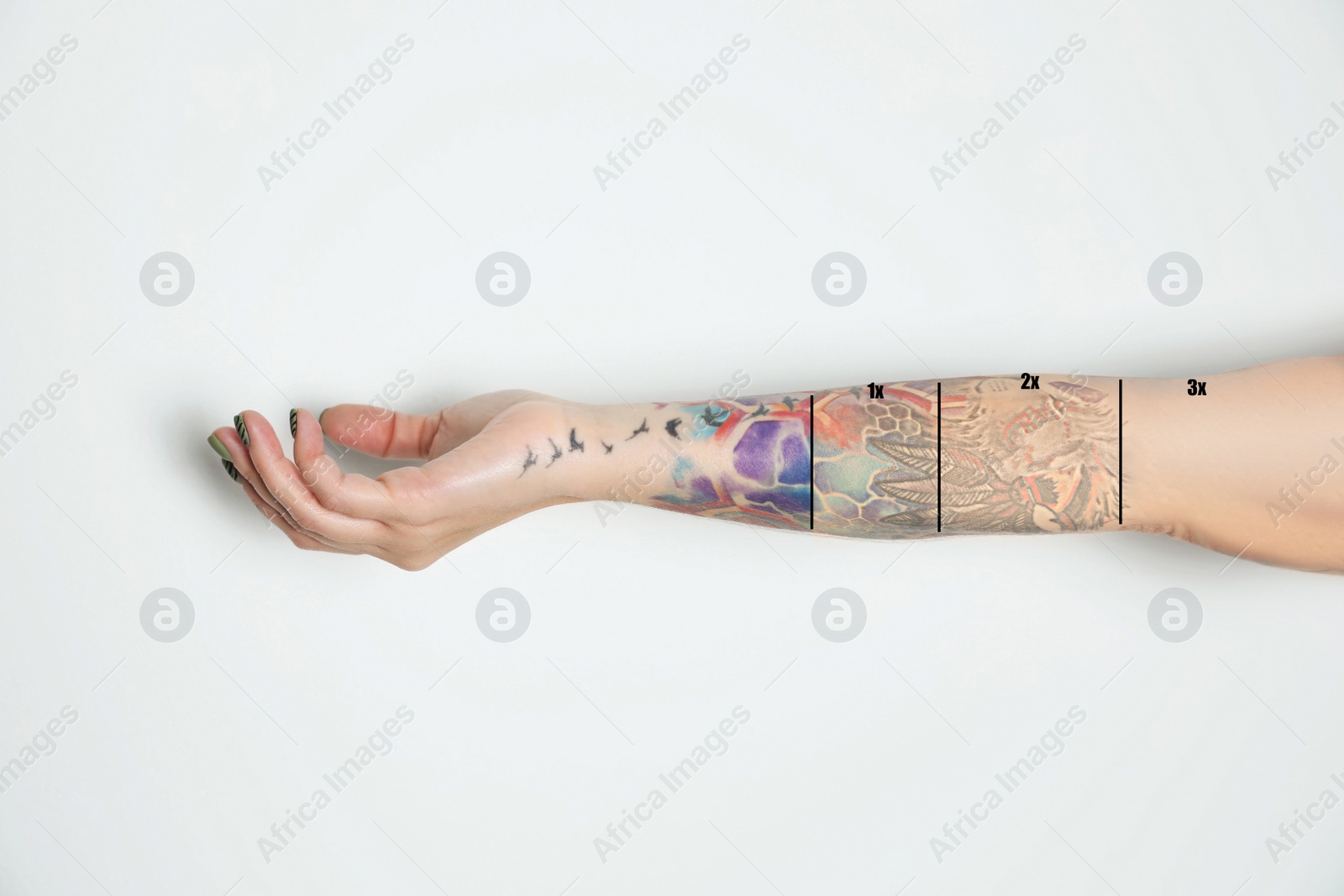 Image of Woman before and after laser tattoo removal procedures on white background, closeup