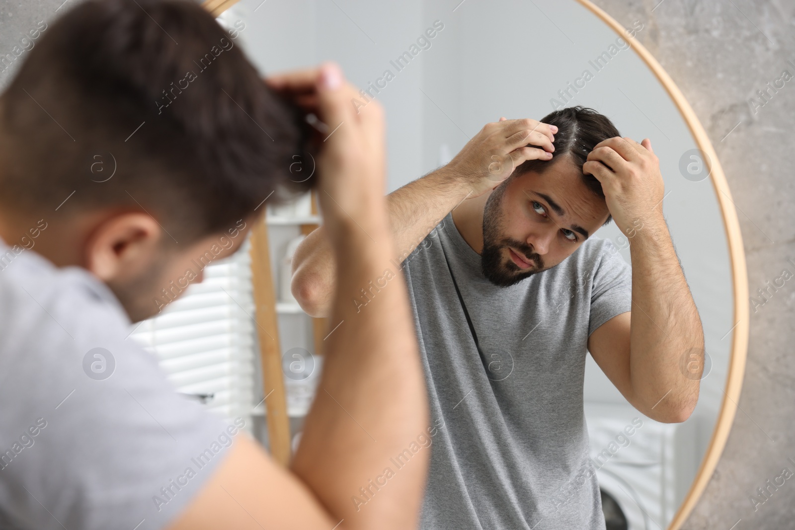 Photo of Man with dandruff in his dark hair near mirror in bathroom