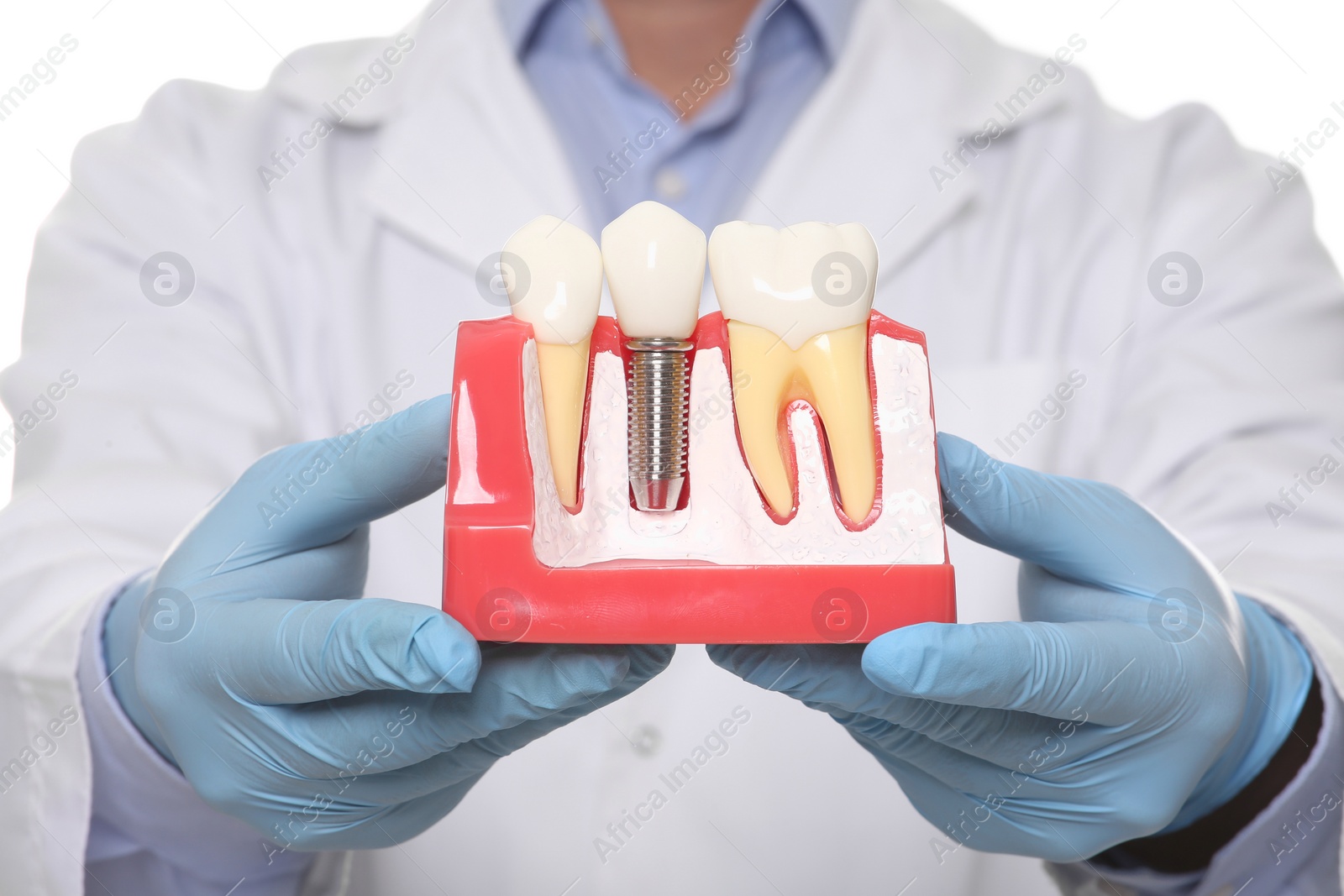 Photo of Dentist holding educational model of dental implant on white background, closeup