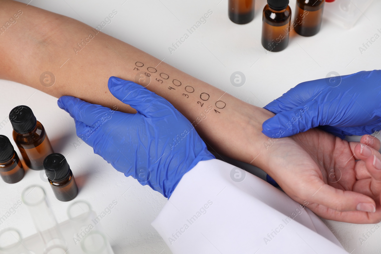 Photo of Doctor doing skin allergy test at light table, closeup