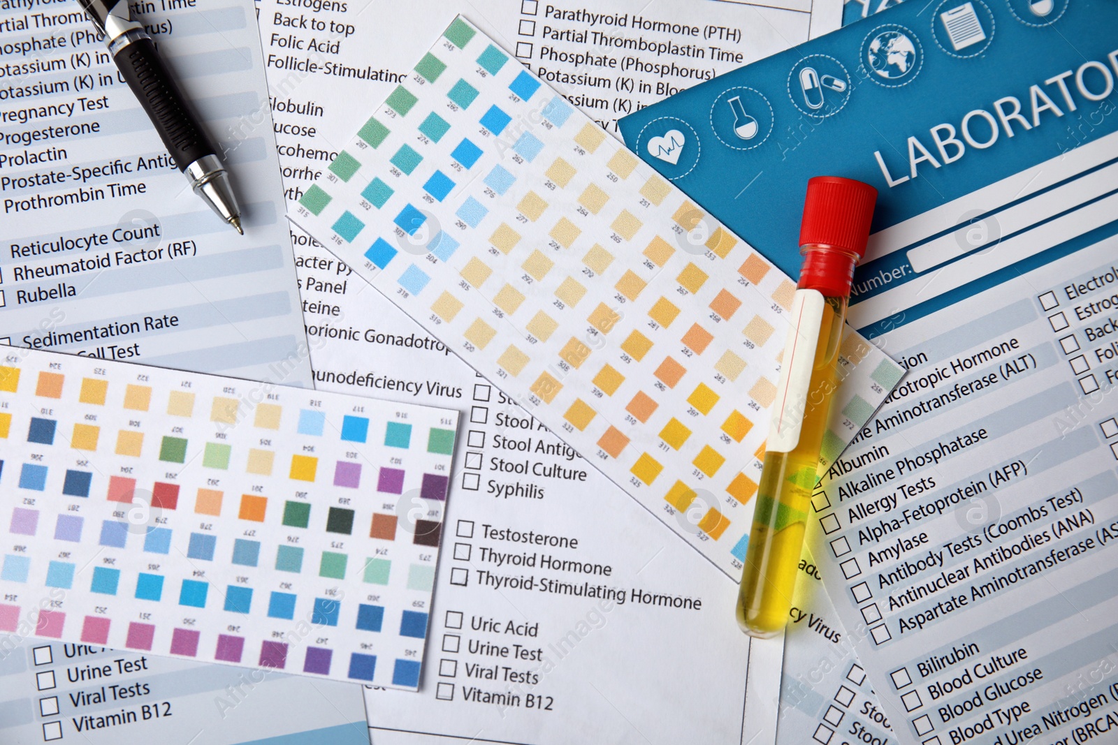 Photo of Test tube with urine sample for analysis on laboratory test form, flat lay