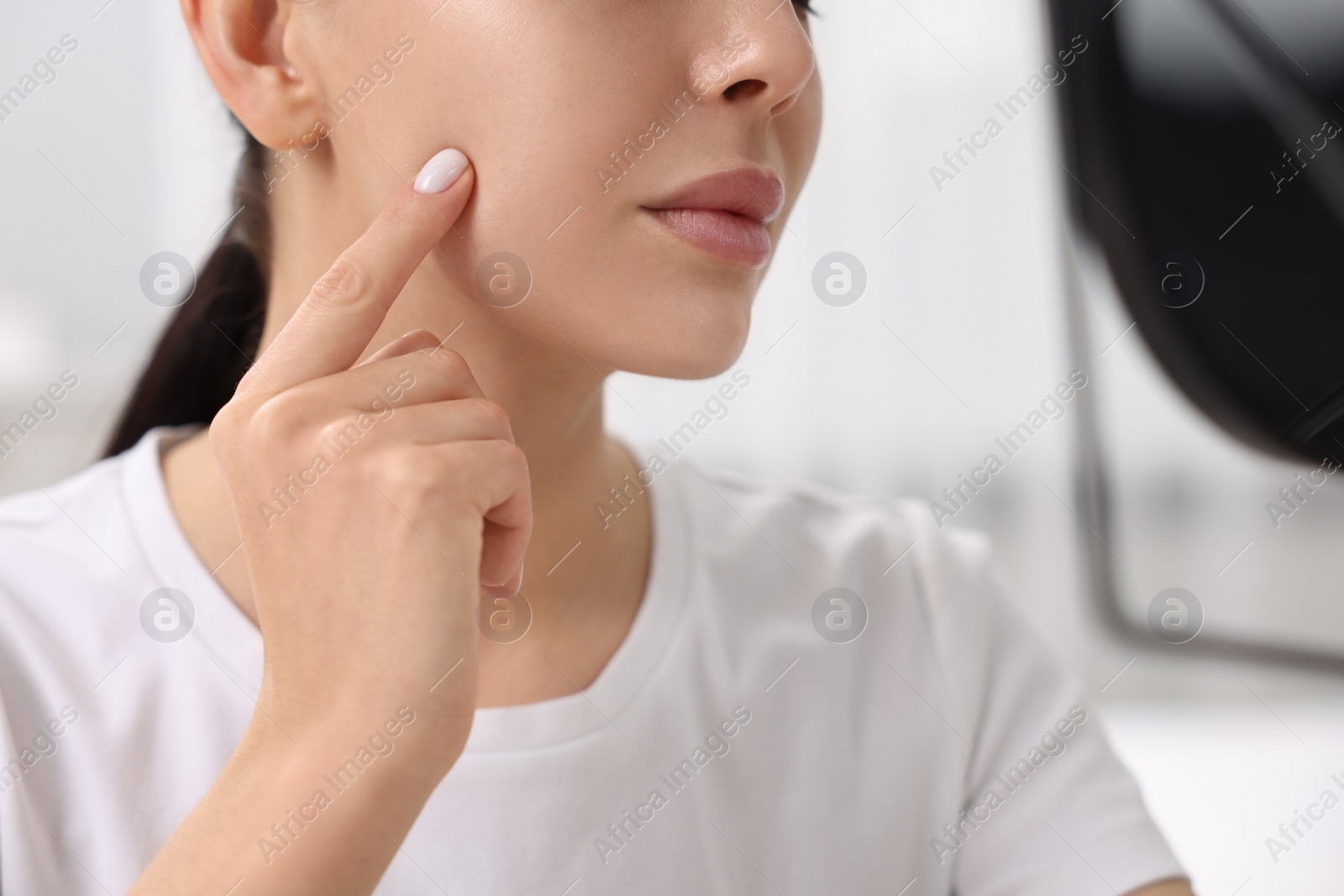 Photo of Woman with dry skin checking her face indoors, closeup