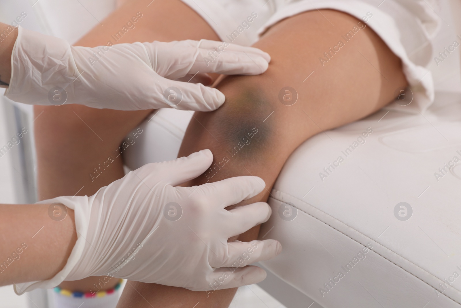 Photo of Doctor examining little child's bruised knee in hospital, closeup