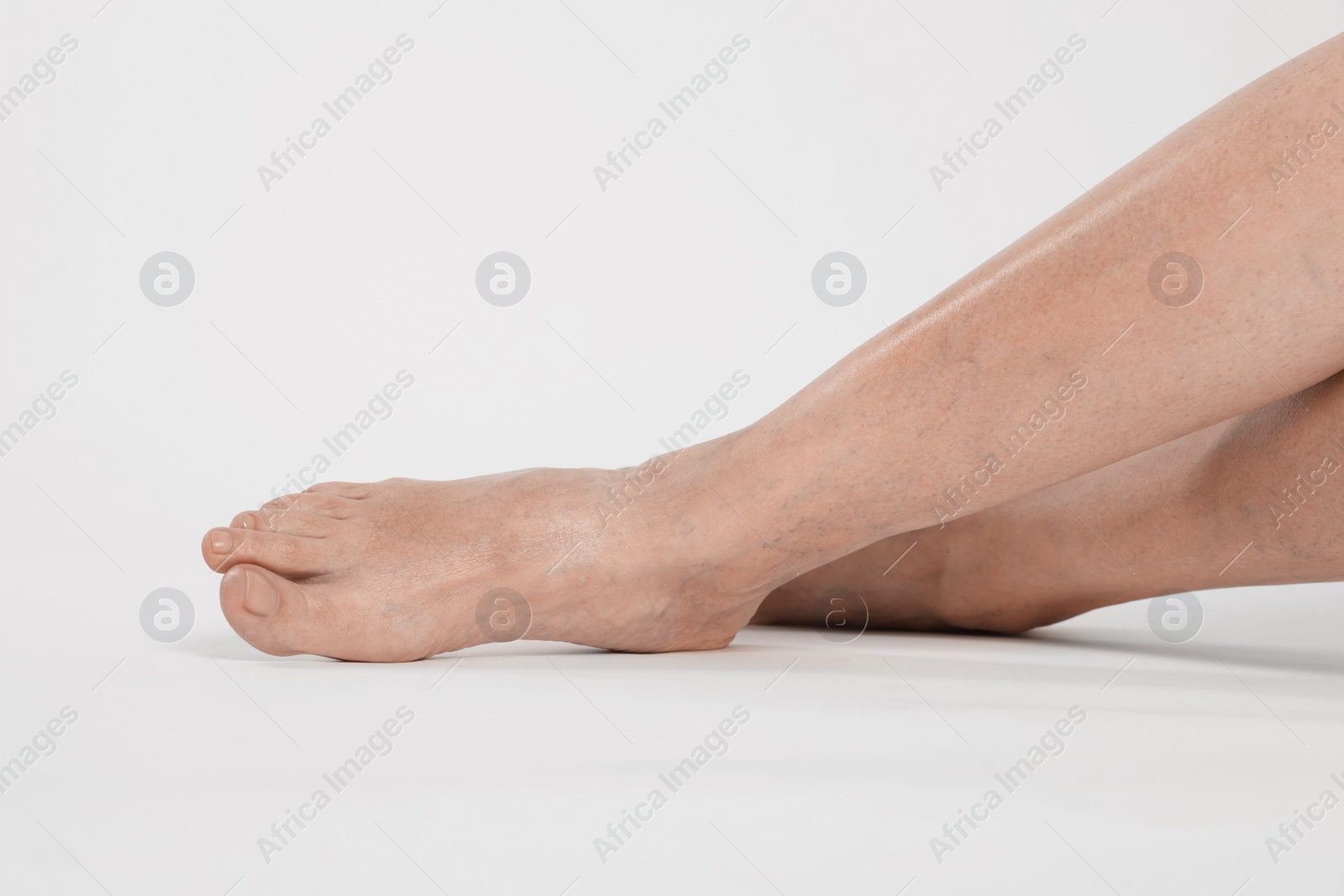 Photo of Closeup view of woman with varicose veins on light background