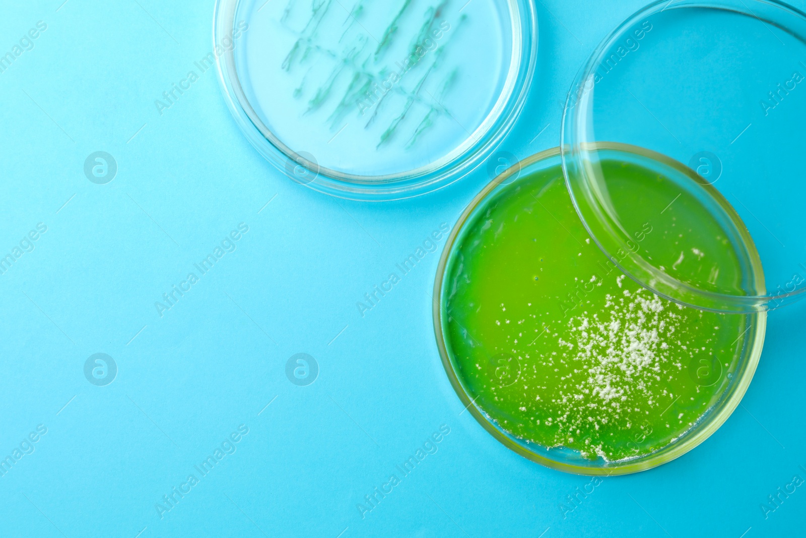 Photo of Petri dishes with different bacteria colonies on light blue background, flat lay. Space for text