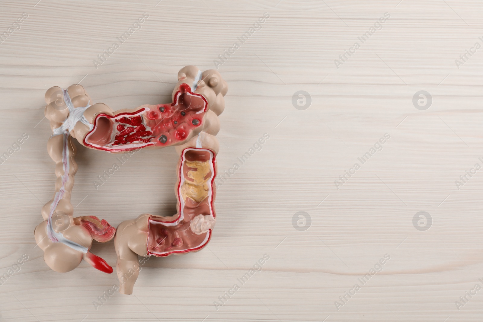 Photo of Human colon model on white wooden table, top view. Space for text