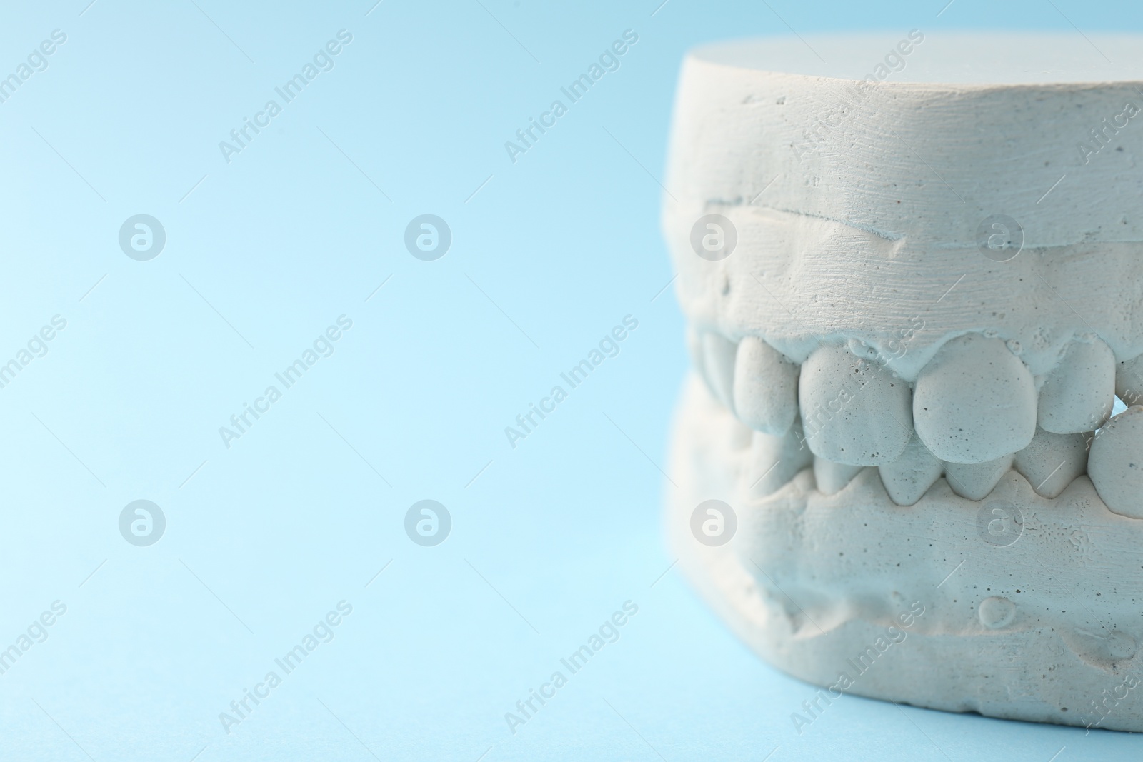 Photo of Dental model with gums on light blue background, closeup and space for text. Cast of teeth