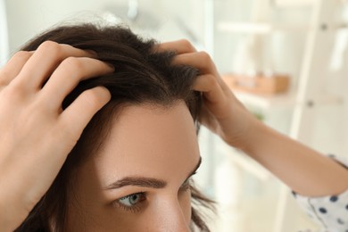 Photo of Woman suffering from baldness at home, closeup