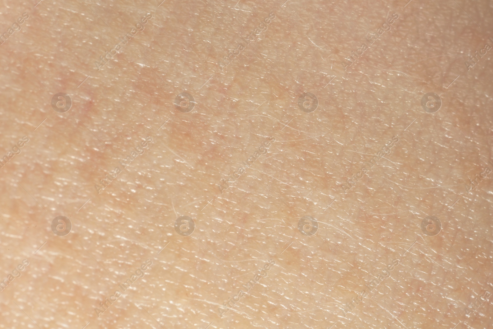 Photo of Texture of dry skin as background, macro view