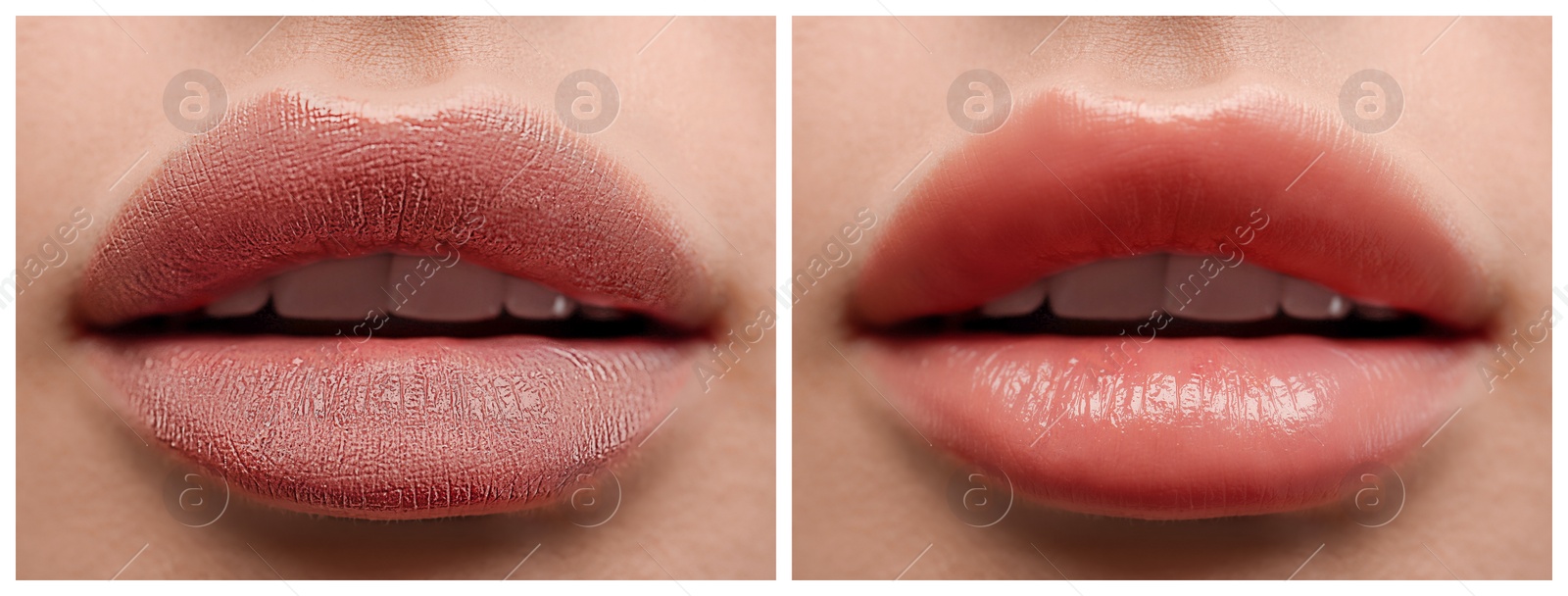 Image of Collage with photos of woman before and after applying cosmetic balm on lips, closeup