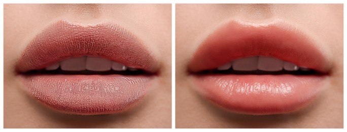 Image of Collage with photos of woman before and after applying cosmetic balm on lips, closeup