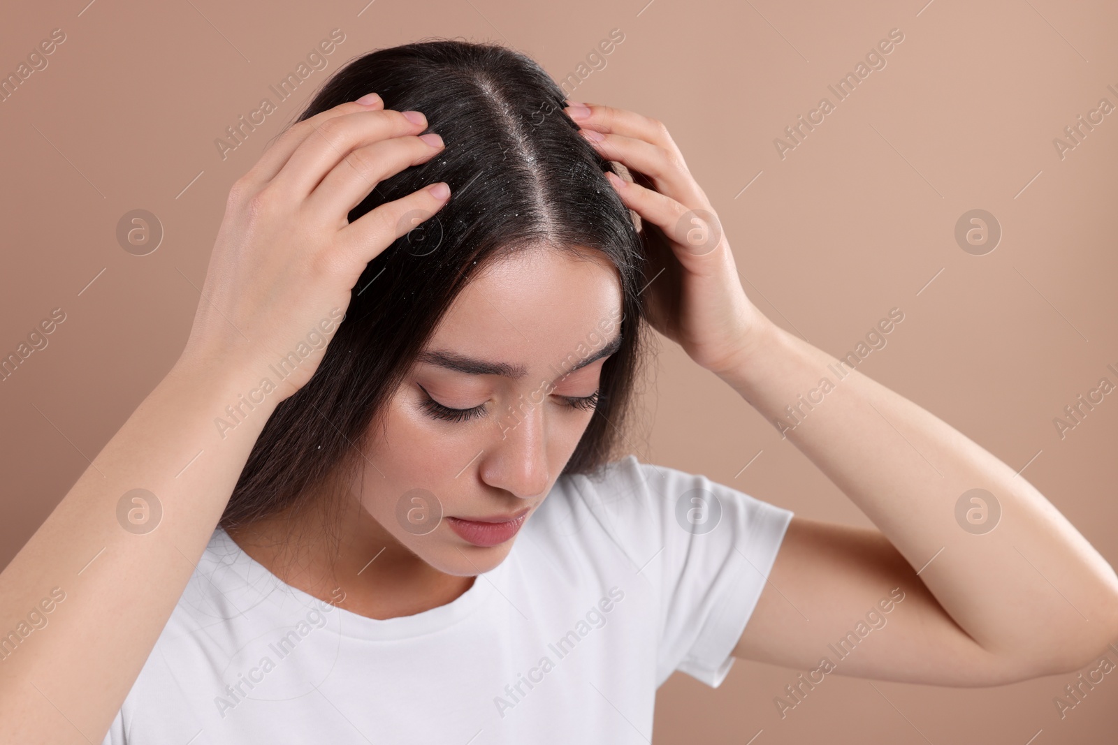 Photo of Woman suffering from dandruff problem on beige background