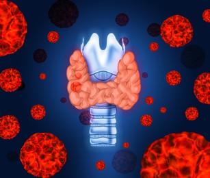 Illustration of Illustration of human thyroid cancer on blue background