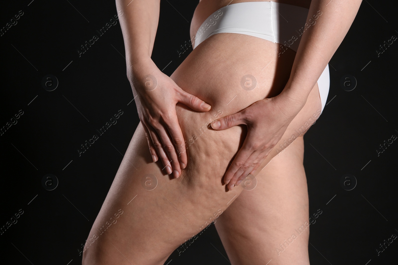 Photo of Woman with cellulite on black background, closeup